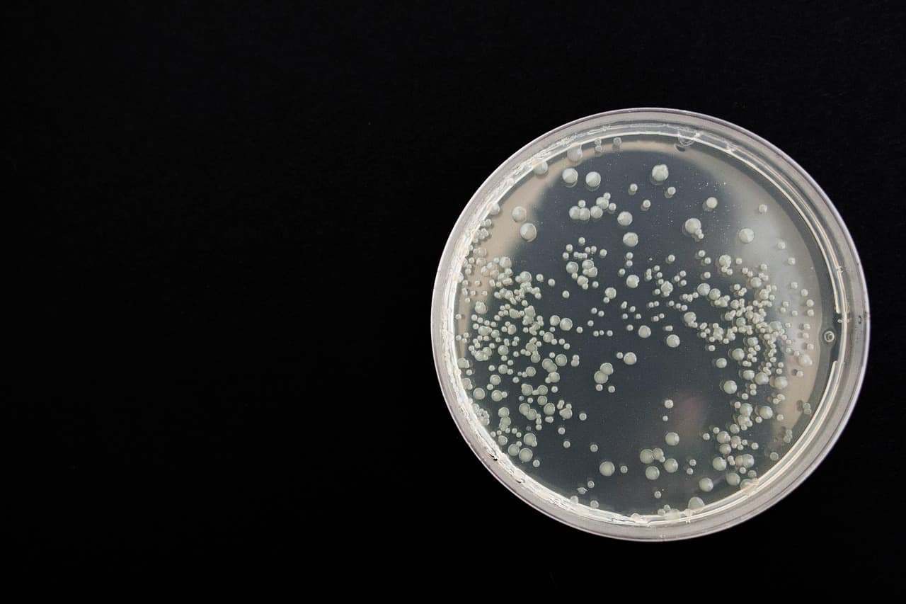 Plague epidemic risk in Russia low, WHO says, as US presses Moscow for details